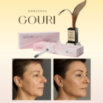Gouri-Derma-Oman-United-Clinics-Collagen